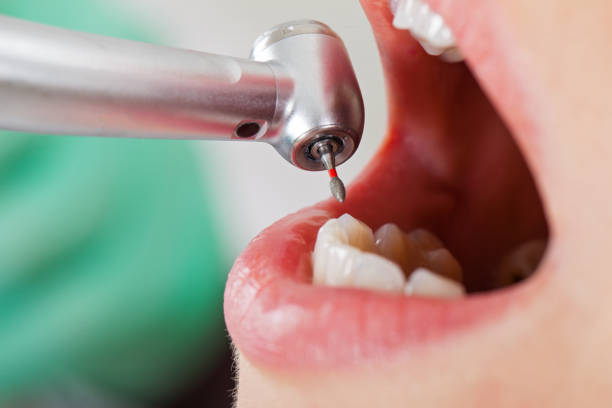 Best Urgent Care for Lost Fillings or Crowns in Lanai City, HI